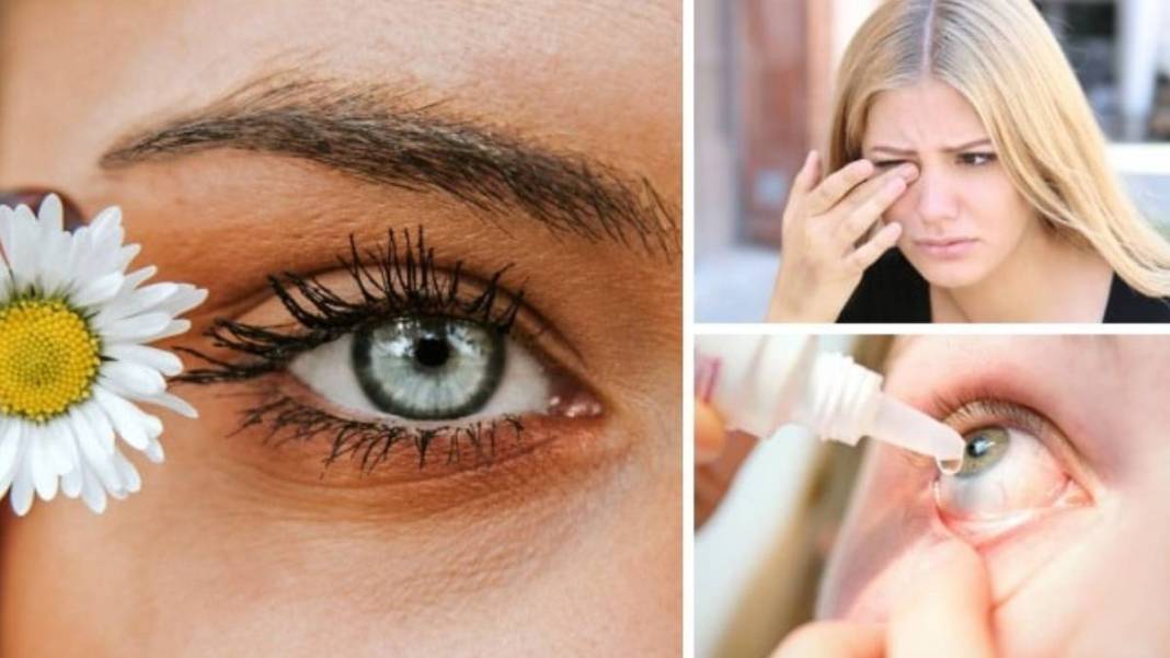 Bahar günlerinde gözünüzden olabilirsiniz! Bu belirtilere dikkat: Önce görme bozukluğuyla başlıyor 1